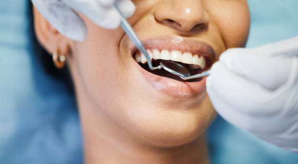 Best Broken or Chipped Tooth Repair in White Rock, NM