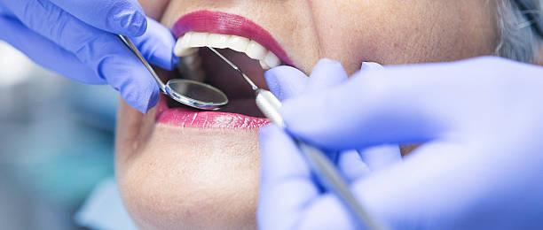 Best Walk-In Emergency Dental Services in White Rock, NM